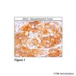 SST2, Somatostatin Receptor 2 Antibody in Immunohistochemistry (Paraffin) (IHC (P))