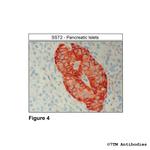 SST2, Somatostatin Receptor 2 Antibody in Immunohistochemistry (Paraffin) (IHC (P))