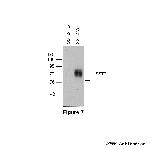 SST2, Somatostatin Receptor 2 Antibody in Western Blot (WB)