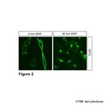 SST2, Somatostatin Receptor 2 Antibody in Immunocytochemistry (ICC/IF)