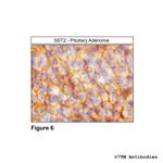 SST2, Somatostatin Receptor 2 Antibody in Immunohistochemistry (PFA fixed) (IHC (PFA))