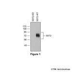 SST2, Somatostatin Receptor 2 Antibody in Western Blot (WB)