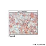 SST5, Somatostatin Receptor 5 Antibody in Immunohistochemistry (Paraffin) (IHC (P))