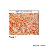 SST5, Somatostatin Receptor 5 Antibody in Immunohistochemistry (Paraffin) (IHC (P))