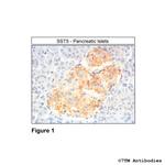 SST5, Somatostatin Receptor 5 Antibody in Immunohistochemistry (Paraffin) (IHC (P))