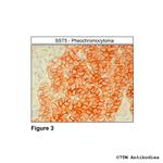 SST5, Somatostatin Receptor 5 Antibody in Immunohistochemistry (Paraffin) (IHC (P))