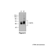 SST5, Somatostatin Receptor 5 Antibody in Western Blot (WB)