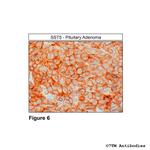 SST5, Somatostatin Receptor 5 Antibody in Immunohistochemistry (PFA fixed) (IHC (PFA))