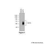 SST5, Somatostatin Receptor 5 Antibody in Western Blot (WB)