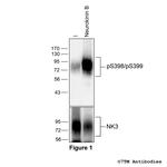 Phospho-Tachykinin Receptor 3 (Ser398, Ser399) Antibody in Western Blot (WB)