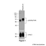 Phospho-VIP Receptor 1 (Ser435, Thr438) Antibody in Western Blot (WB)