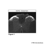 N/OFQ, Nociceptin/Orphanin FQ Antibody in Immunohistochemistry (Paraffin) (IHC (P))