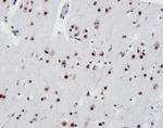 TDP-43 Antibody in Immunohistochemistry (IHC)