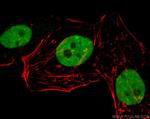 TDP-43 Antibody in Immunocytochemistry (ICC/IF)