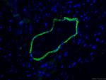 smooth muscle actin Antibody in Immunohistochemistry (Paraffin) (IHC (P))