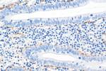 smooth muscle actin Antibody in Immunohistochemistry (Paraffin) (IHC (P))