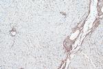 smooth muscle actin Antibody in Immunohistochemistry (Paraffin) (IHC (P))