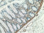 smooth muscle actin Antibody in Immunohistochemistry (Paraffin) (IHC (P))