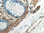 smooth muscle actin Antibody in Immunohistochemistry (Paraffin) (IHC (P))