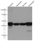 smooth muscle actin Antibody in Western Blot (WB)