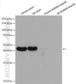 smooth muscle actin Antibody in Western Blot (WB)