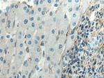 Collagen Type III Antibody in Immunohistochemistry (Paraffin) (IHC (P))