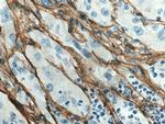 Collagen Type III Antibody in Immunohistochemistry (Paraffin) (IHC (P))