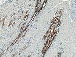 Collagen Type III Antibody in Immunohistochemistry (Paraffin) (IHC (P))