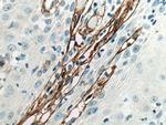 Collagen Type III Antibody in Immunohistochemistry (Paraffin) (IHC (P))