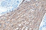 Collagen Type III Antibody in Immunohistochemistry (Paraffin) (IHC (P))