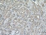 calreticulin Antibody in Immunohistochemistry (Paraffin) (IHC (P))