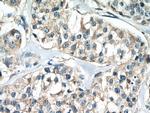 calreticulin Antibody in Immunohistochemistry (Paraffin) (IHC (P))