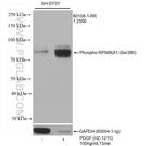 Phospho-RPS6KA1 (Ser380) Antibody in Western Blot (WB)