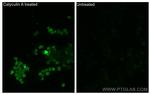 Phospho-STK11 (Thr189) Antibody in Immunocytochemistry (ICC/IF)