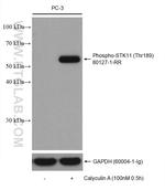 Phospho-STK11 (Thr189) Antibody in Western Blot (WB)