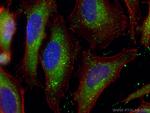 PEX14 Antibody in Immunocytochemistry (ICC/IF)