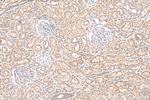 PEX14 Antibody in Immunohistochemistry (Paraffin) (IHC (P))