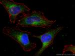 PEX14 Antibody in Immunocytochemistry (ICC/IF)