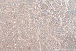 PEX14 Antibody in Immunohistochemistry (Paraffin) (IHC (P))