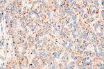 PEX14 Antibody in Immunohistochemistry (Paraffin) (IHC (P))