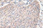 PEX14 Antibody in Immunohistochemistry (Paraffin) (IHC (P))