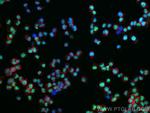 METTL3 Antibody in Immunocytochemistry (ICC/IF)