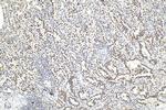 METTL3 Antibody in Immunohistochemistry (Paraffin) (IHC (P))