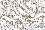 METTL3 Antibody in Immunohistochemistry (Paraffin) (IHC (P))