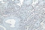 METTL3 Antibody in Immunohistochemistry (Paraffin) (IHC (P))