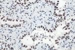 METTL3 Antibody in Immunohistochemistry (Paraffin) (IHC (P))