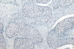 METTL3 Antibody in Immunohistochemistry (Paraffin) (IHC (P))