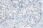 METTL3 Antibody in Immunohistochemistry (Paraffin) (IHC (P))