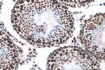 METTL3 Antibody in Immunohistochemistry (Paraffin) (IHC (P))