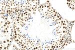 METTL3 Antibody in Immunohistochemistry (Paraffin) (IHC (P))